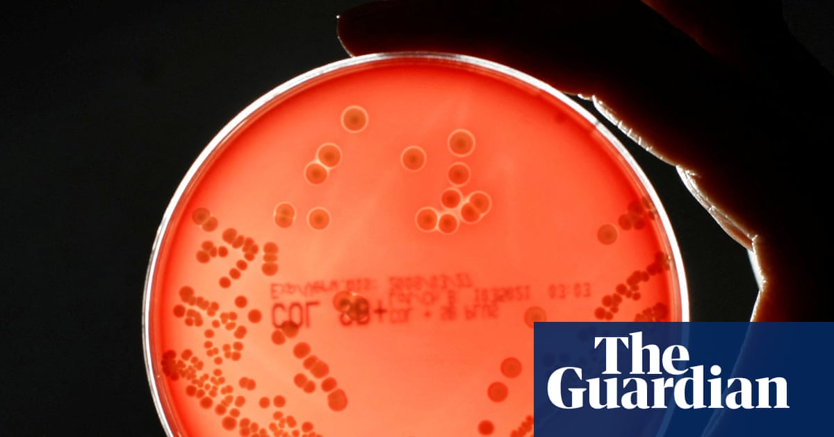 Antibiotic-Resistant Superbug-Related Deaths in England Increased by 17% in 2024 – Mirror Brief